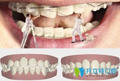 巫强平主任科普成人正畸与儿童正畸有什么区别 巫强平主任科普成人正畸与儿童正畸有什么区别