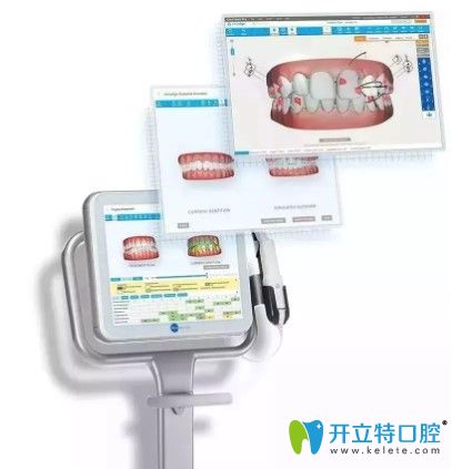 青岛维乐口腔iTero口扫 青岛维乐口腔iTero口扫