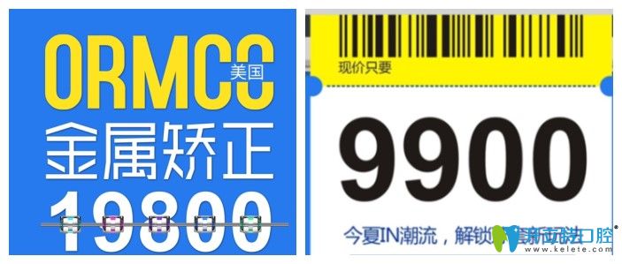 成都圣贝口腔美国奥美科金属矫正价格 成都圣贝口腔美国奥美科金属矫正价格