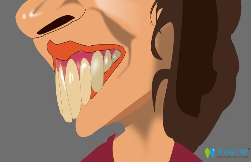 美容冠矫正龅牙有效果吗？和传统牙齿矫正相比有什么区别?