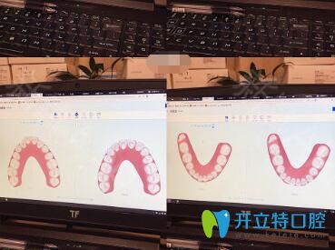 我在上海亿大口腔做牙齿矫正前检查