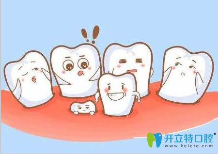 拔牙后的口腔注意事项介绍