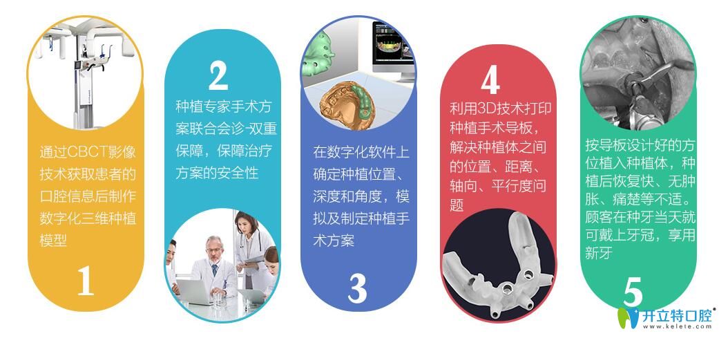 博韵口腔靶向种植技术解析