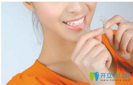 隐适美隐形牙套图示 隐适美隐形牙套图示