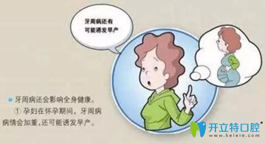 做好孕期口腔保健可预防龋齿