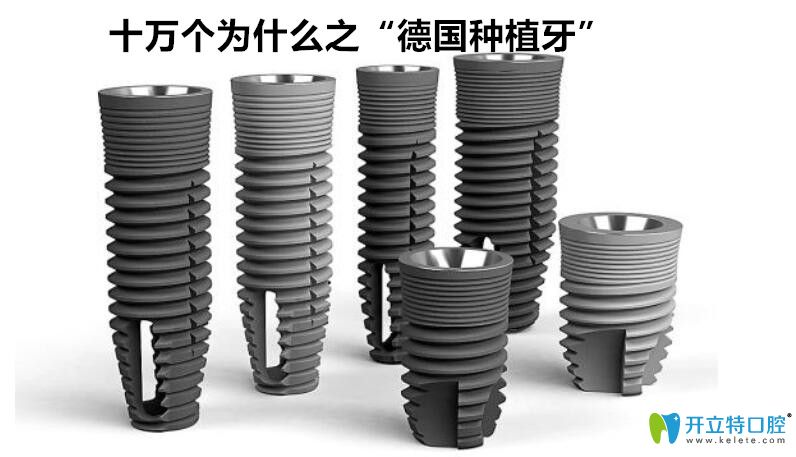 德国种植牙品牌及价格是多少?看完再说德国植体什么牌子好