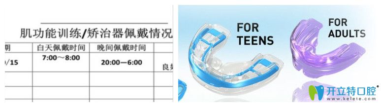 维乐口腔佩戴记录表和儿童矫正器图示