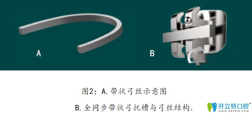 全同步带状弓矫治技术原理