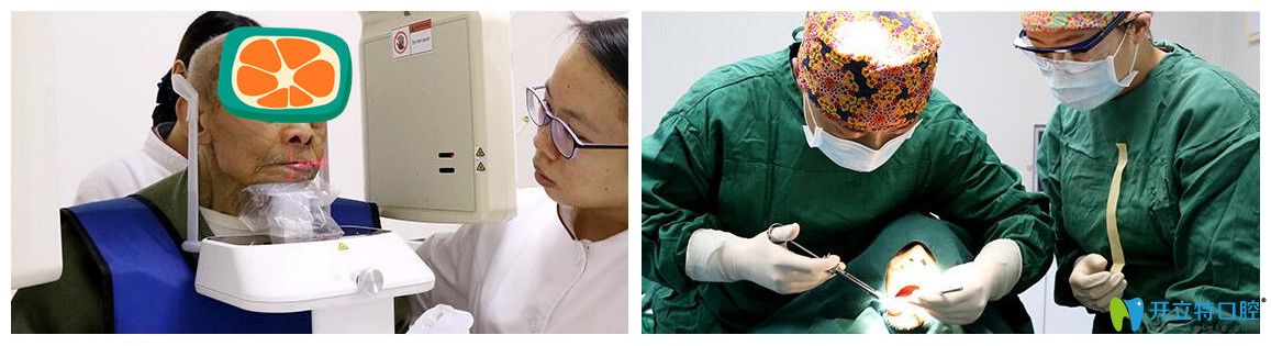 侯主任为韩老实施精准种植手术图 侯主任为韩老实施精准种植手术图