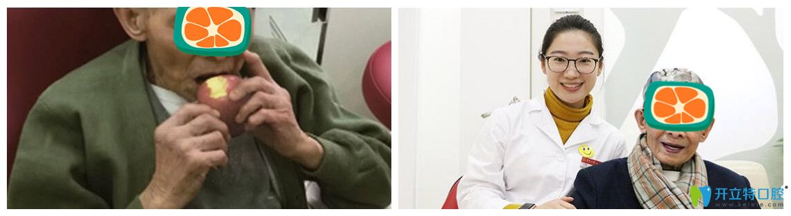 广州广大口腔的韩重声老人做种植牙之后的留影 广州广大口腔的韩重声老人做种植牙之后的留影
