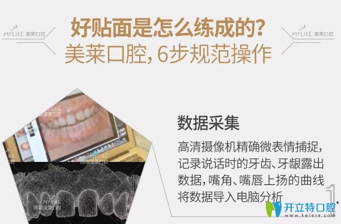 深圳美莱口腔隐形臻薄牙贴面6不规范操作 深圳美莱口腔隐形臻薄牙贴面6不规范操作