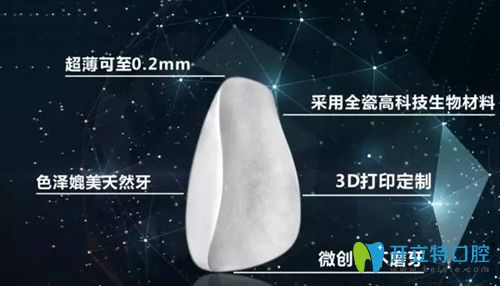 牙贴面优势宣传图