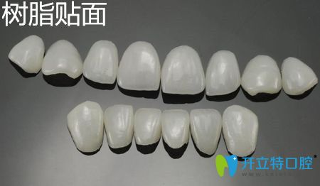 树脂贴面 树脂贴面