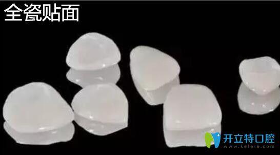 全瓷贴面 全瓷贴面
