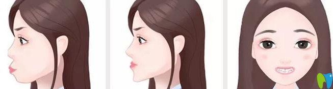 20190903252743.png