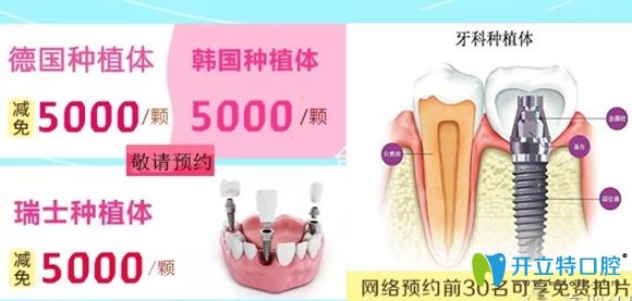 美佳德口腔做种植牙网络预约前30名可享免费拍片