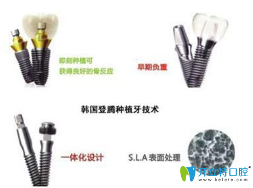 登腾种植体工艺处理 登腾种植体工艺处理