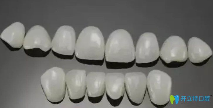 南京康美提示哪些牙齿适合做牙齿贴面