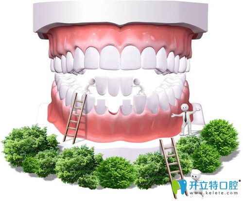 烤瓷牙好不好 烤瓷牙好不好