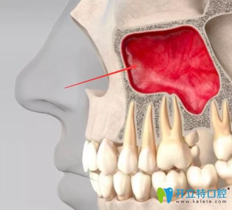 上颌窦位置图片