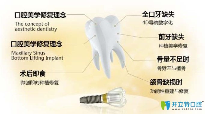 宁波吉恩做种植牙好的原因