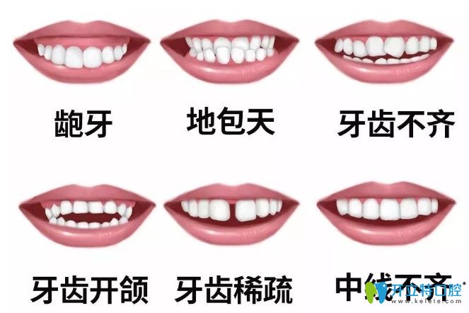 中秋不妨趁着维乐口腔牙齿矫正价格优惠来做正畸 中秋不妨趁着维乐口腔牙齿矫正价格优惠来做正畸