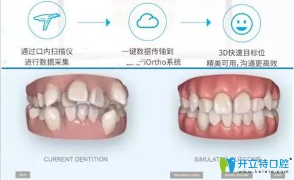 乐山英美口腔的口扫设备图 乐山英美口腔的口扫设备图