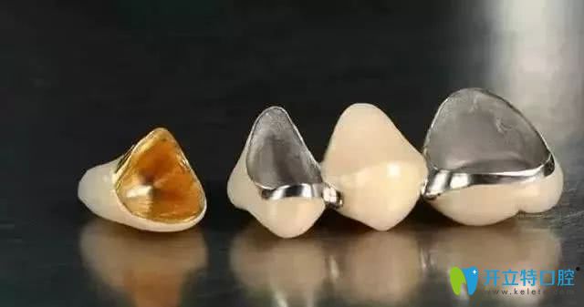 烤瓷牙的效果图