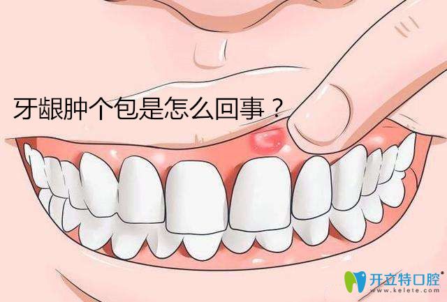 【有问必答】牙龈肿个包是怎么回事,怎么治疗好的更快?