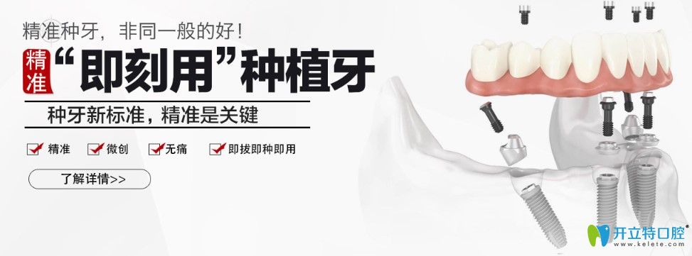 广州广大口腔精准即刻用种植牙优势