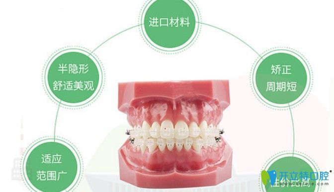 拜尔口腔牙齿矫正特色技术之半隐形矫正