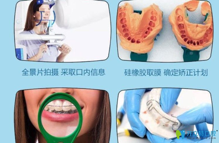 深圳格伦菲尔口腔做牙齿矫正的流程 深圳格伦菲尔口腔做牙齿矫正的流程