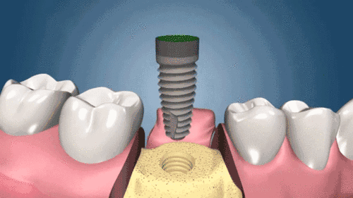 20190927765891.gif 11.gif