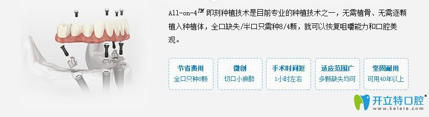 All-on-4即刻种植牙的简介及优势图 All-on-4即刻种植牙的简介及优势图