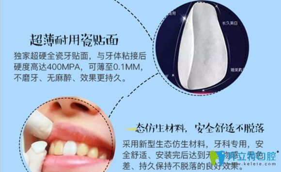韦博口腔的E-max瓷贴面美白优势介绍图 韦博口腔的E-max瓷贴面美白优势介绍图