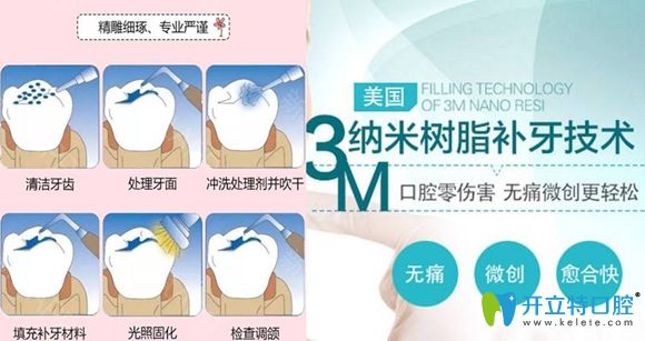 3M树脂补牙优势图