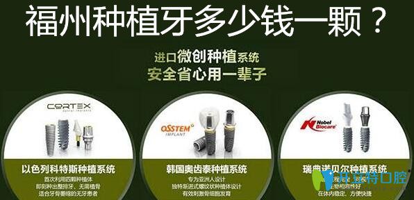 福州种植牙多少钱一颗