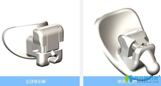 ebrace/易美正畸自锁矫正 ebrace/易美正畸自锁矫正