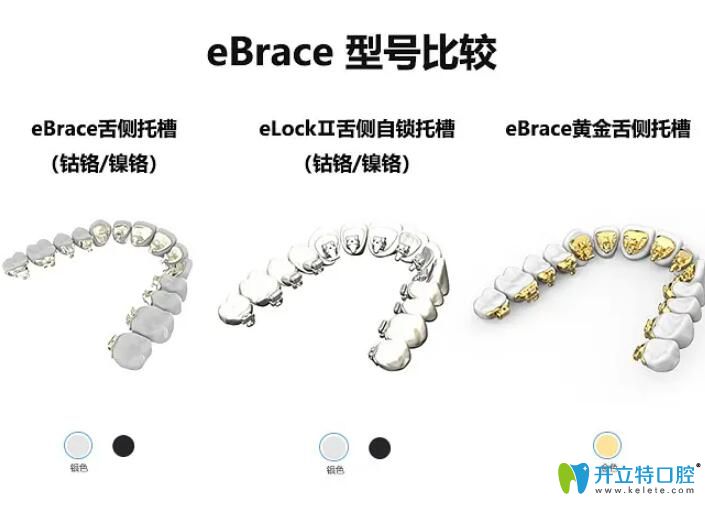 易美正畸型号 易美正畸型号