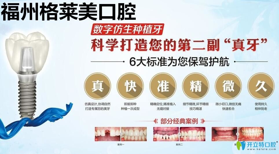 福州格莱美口腔数字仿生种植牙技术