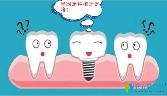 修复缺牙是选半口半固定种植牙还是固定种植好呢,区别在哪