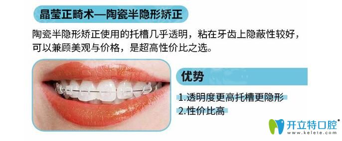 陶瓷托槽半隐形矫正优势 陶瓷托槽半隐形矫正优势