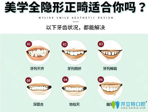 美学矫正适用情况