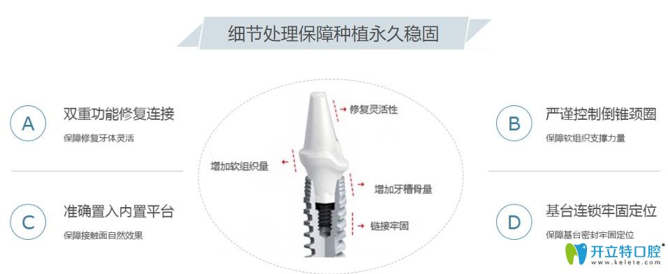 优贝口腔的设备先进细节处理到位 优贝口腔的设备先进细节处理到位