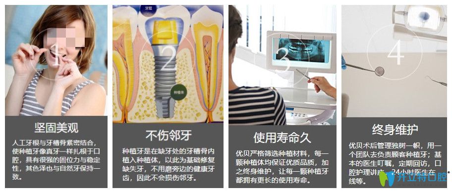 优贝口腔种植牙的4大优势 优贝口腔种植牙的4大优势