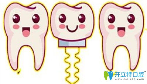 牙齿缺失可选择种植牙