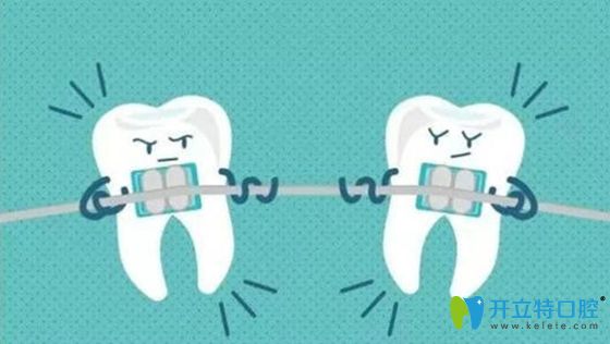 牙周病和牙齿正畸之间关系密不可分