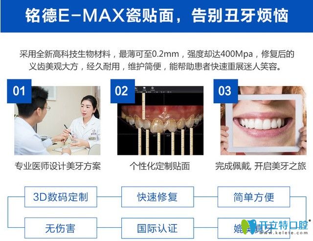 铭德E-MAX瓷贴面介绍