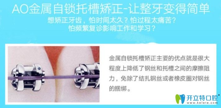 Ao自锁托槽矫正优势 Ao自锁托槽矫正优势