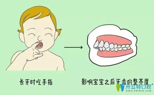 孩子长牙时候吃手指容易导致牙齿畸形